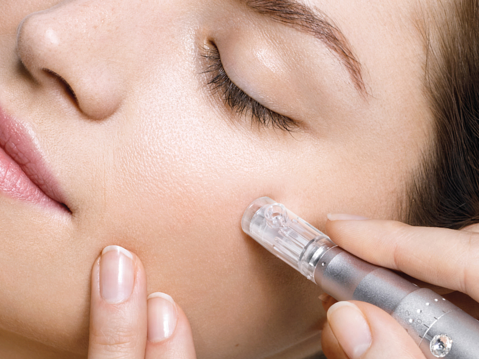 Microneedling + BBGlow Behandlung